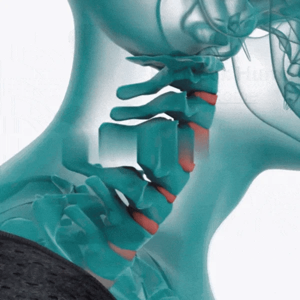 Corrector postural Pro