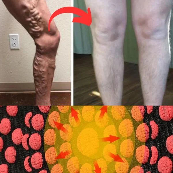 Meias Terapêuticas de Acupressão com Turmalina