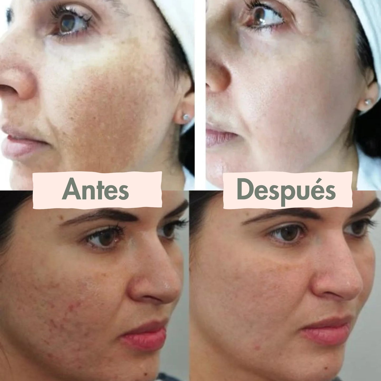 1+2 Crema Reparadora  Veneno de Abeja