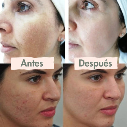 1+2 Crema Reparadora  Veneno de Abeja