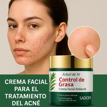 Creme Antiacne Árvore do Chá SADOER 50ml (1+1)