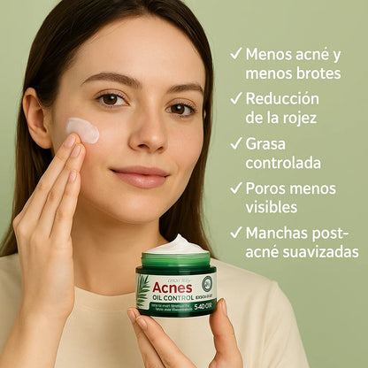 Creme Antiacne Árvore do Chá SADOER 50ml (1+1)