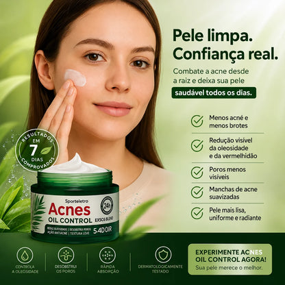 Crema Antiacné Árbol de Té  50ml (1+1)